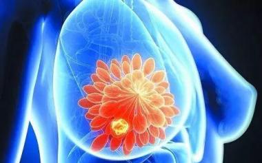研究稱抗氧化食物可降低患乳腺癌風(fēng)險，女性25歲后每年檢查