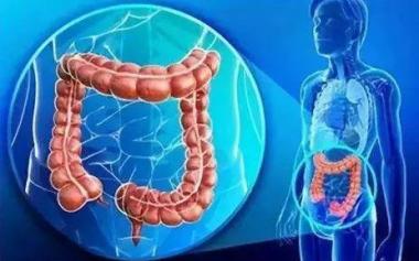 全球大腸癌日益年輕化！小心了，9成大腸癌源于息肉癌變！