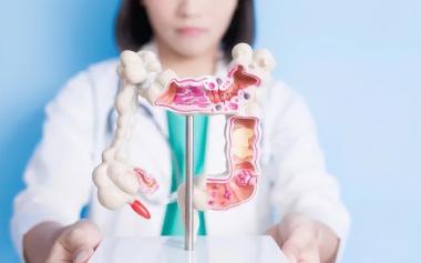 腸癌患者確診超八成已是中晚期！如何識別腸癌早期信號？